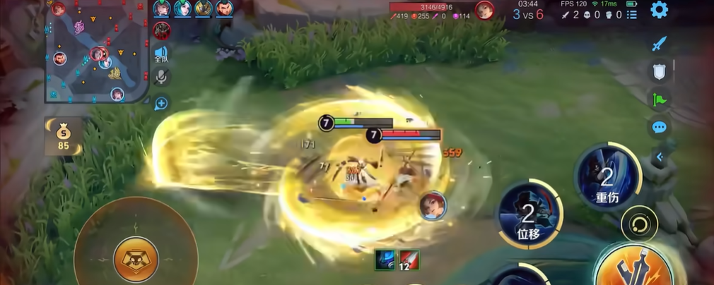 王者荣耀宫本的出装有什么推荐